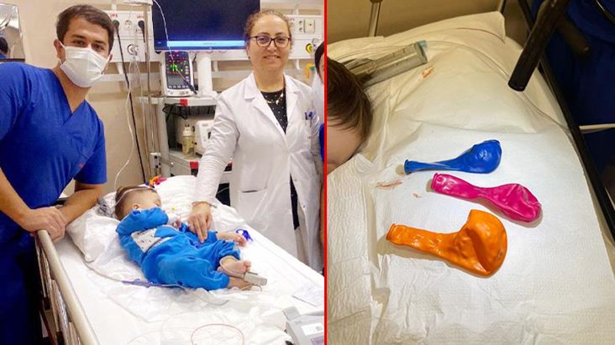 Bir yaşındaki çocuğun midesinden 3 tane balon çıkarıldı