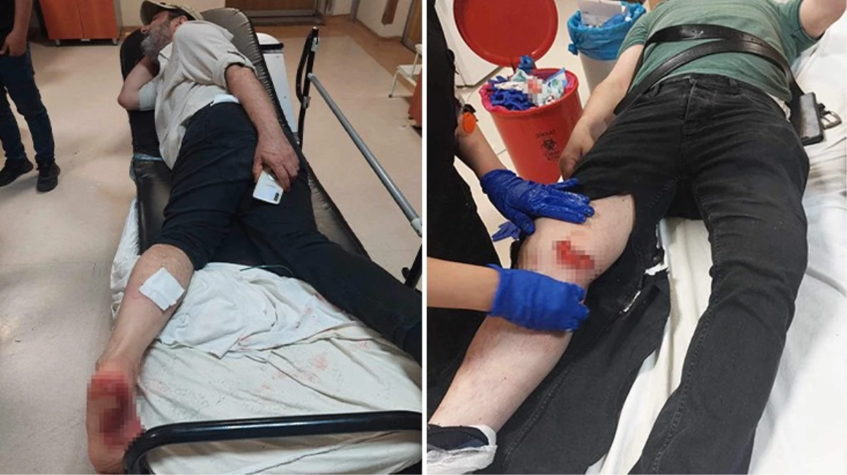 Başkent'in göbeğinde başıboş sokak köpekleri 2 kişiyi hastanelik etti