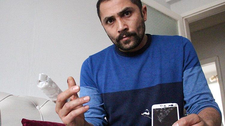 Bomba gibi patlayan powerbank parmağını kopardı!