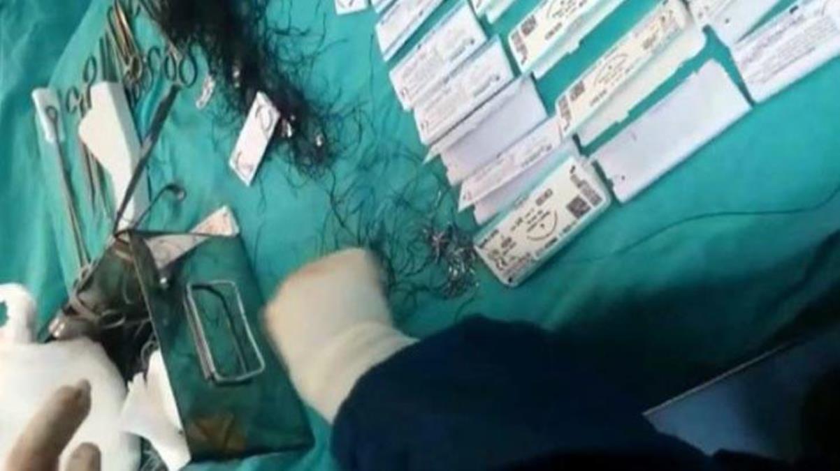 Doktorun ameliyatta 67 denemede sağlam dikiş ipi bulması gündem oldulüğü'nden açıklama geldi