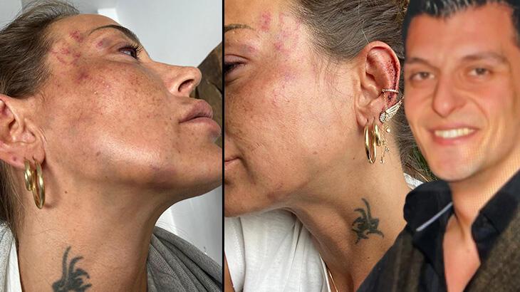 Eski sevgilisi tarafından dövüldü! 12 yıl hapsi istendi