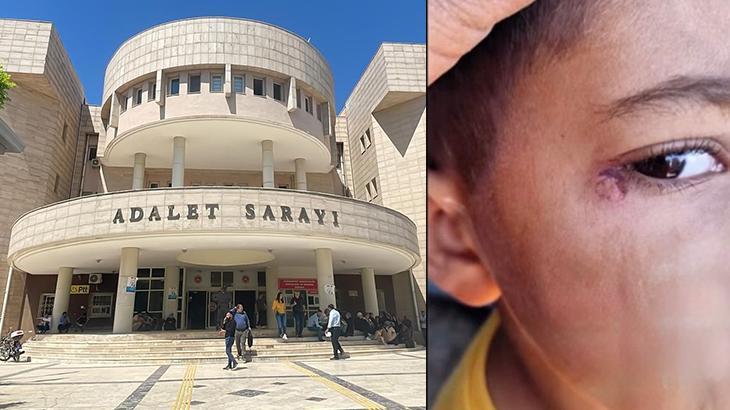 İlkokul öğrencisinin yüzünde sigara söndürdü! Temizlik görevlisi tutuklandı