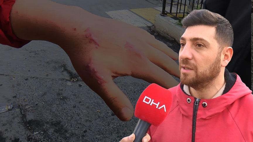 Kedisi elini ısırdı, 13 gün sonra kabusu yaşadı: Dünya tıp literatüründe bir ilk