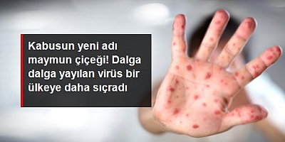 Kabusun yeni adı maymun çiçeği! 