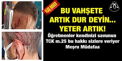 Yeter Artık... MEB Uyuyor Mu?